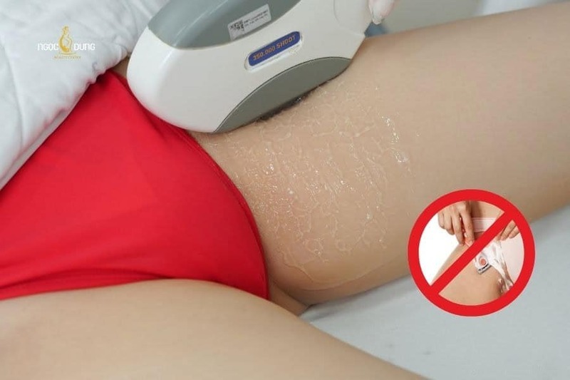 Triệt lông bikini cần được thực hiện đúng kỹ thuật để hạn chế đỏ rát, kích ứng hoặc bỏng da.
