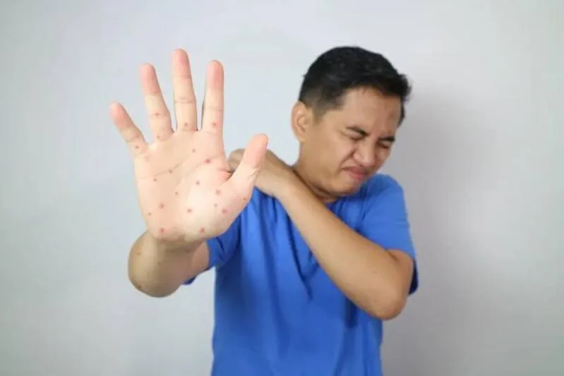 Không uống được nước, khó thở, yếu tay chân hoặc rối loạn ý thức là những biểu hiện không nên tiếp tục theo dõi tại nhà.