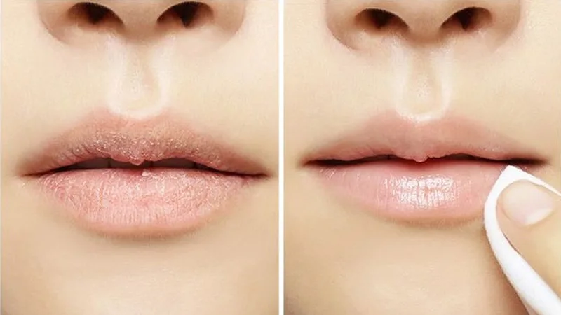 Thao tác đúng giúp bề mặt môi mịn hơn, hạn chế son lì bám thành từng mảng.